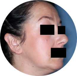 Patient face image