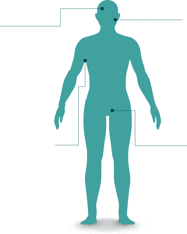 Body