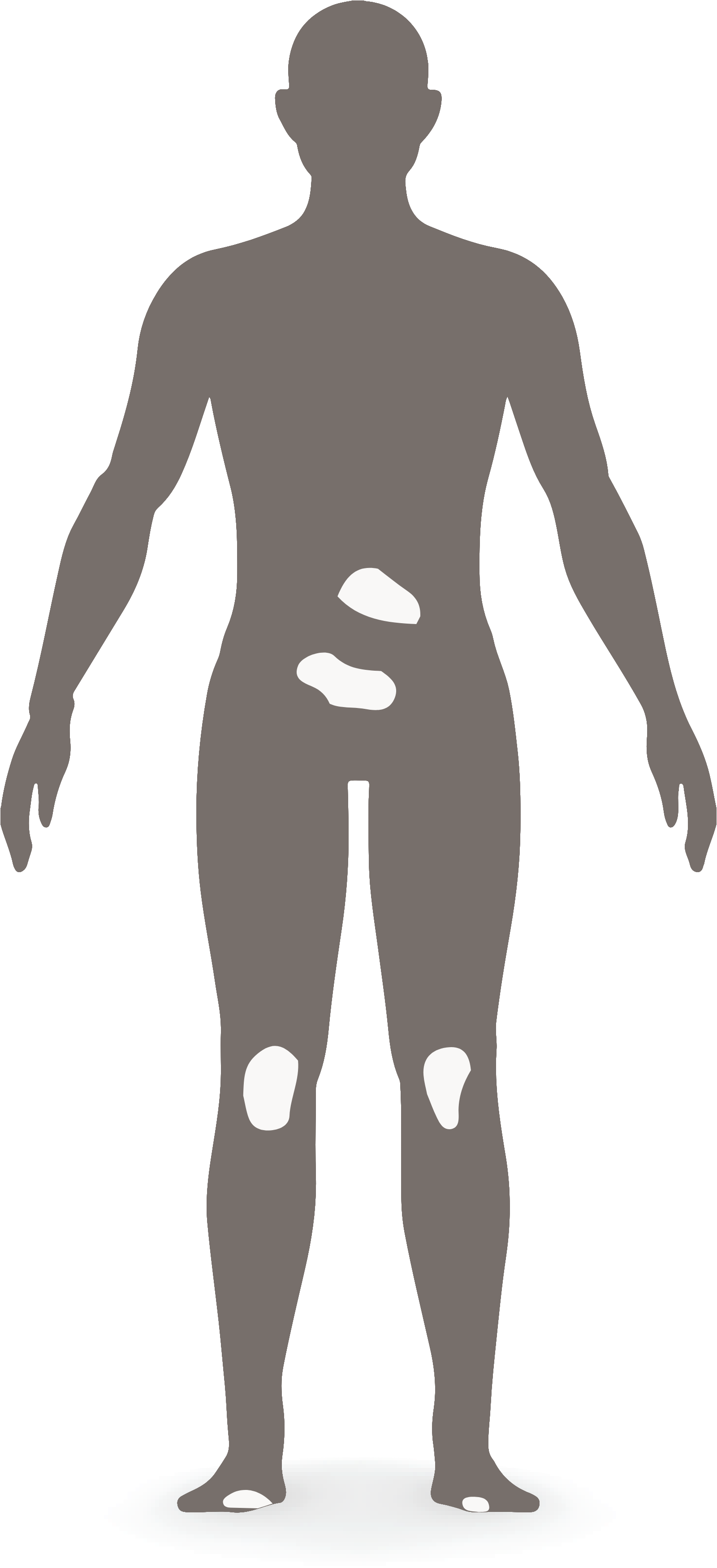 Moderate PsO diagram