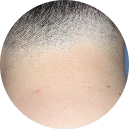 Patient scalp image