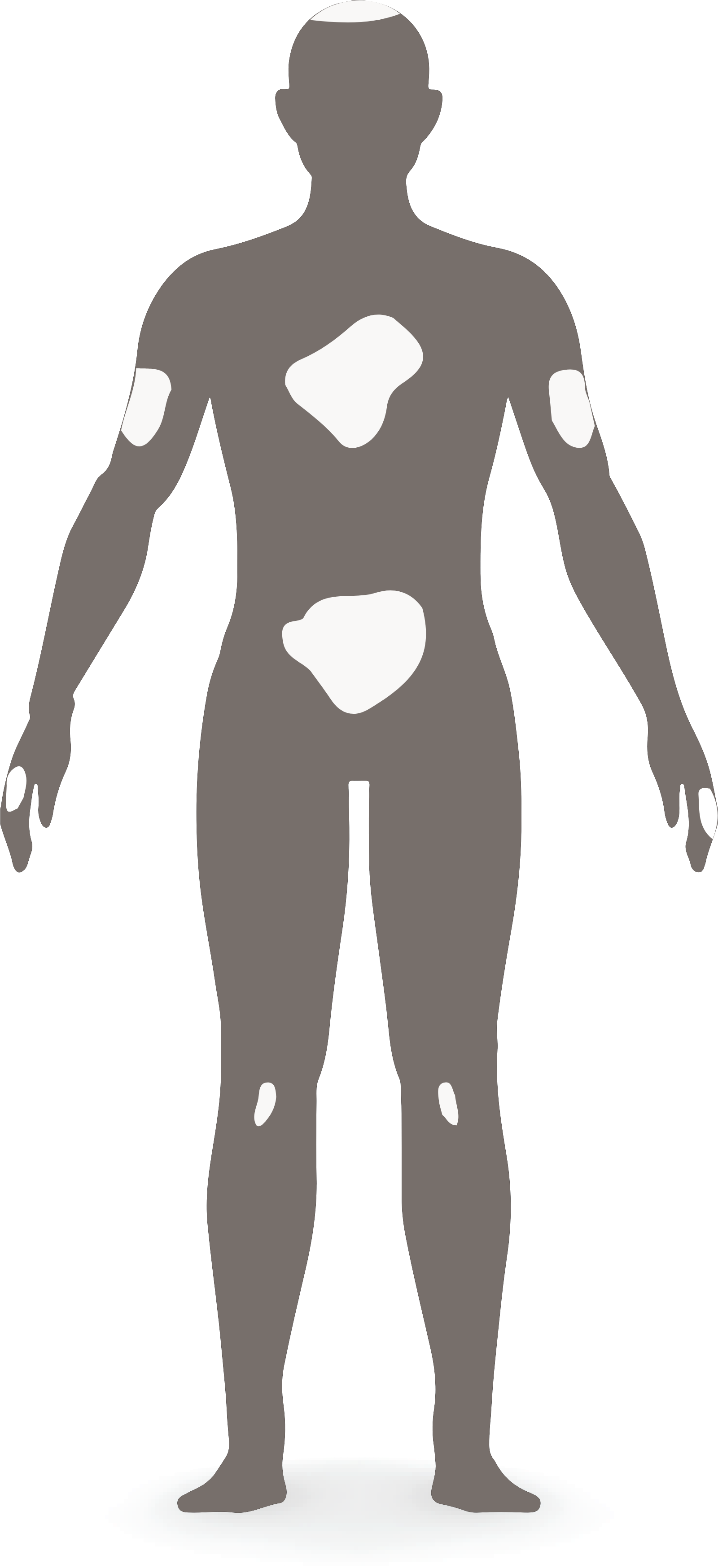 Severe PsO diagram